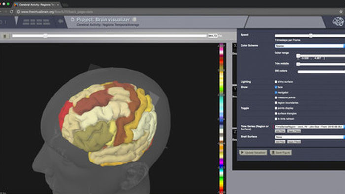 Researchers use patient data to simulate brain functions